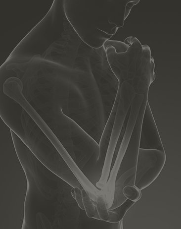 elbow x-ray
