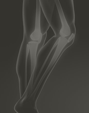 computer generated image showing an x-ray of someone's legs