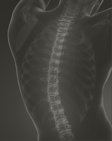 Spine x-ray