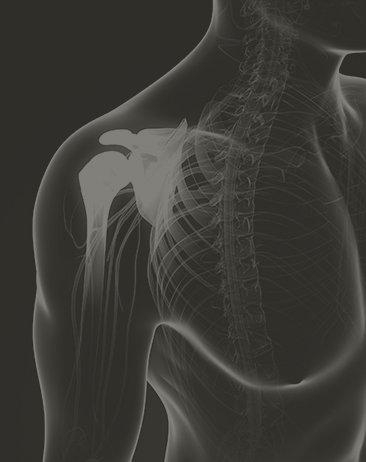 3D-rendered x-ray of shoulder bone with frozen shoulder