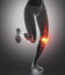 computer generated image showing legs running with knee pain illustration