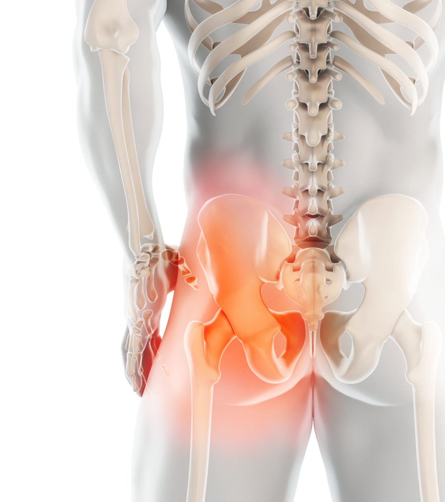 Hip replacement surgery with Redwood Orthopedic